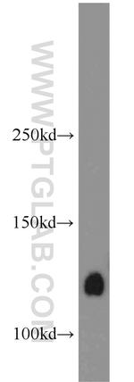 CNOT3 Antibody in Western Blot (WB)