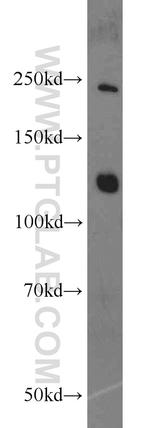 CNOT3 Antibody in Western Blot (WB)