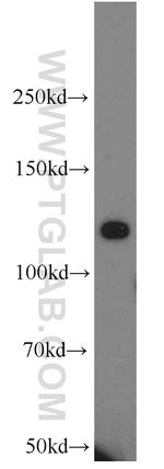 CNOT3 Antibody in Western Blot (WB)