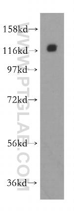 CNOT3 Antibody in Western Blot (WB)