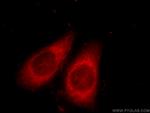 GNAI2 Antibody in Immunocytochemistry (ICC/IF)