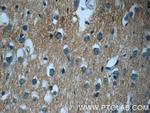 GNAI2 Antibody in Immunohistochemistry (Paraffin) (IHC (P))
