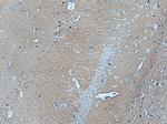 GNAI2 Antibody in Immunohistochemistry (Paraffin) (IHC (P))