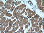PCCB Antibody in Immunohistochemistry (Paraffin) (IHC (P))