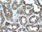 PCCB Antibody in Immunohistochemistry (Paraffin) (IHC (P))