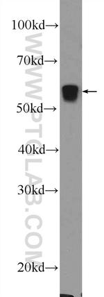 PCCB Antibody in Western Blot (WB)