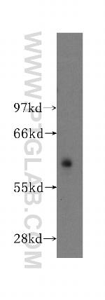 ATP1B3 Antibody in Western Blot (WB)