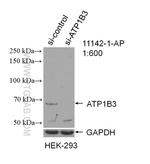 ATP1B3 Antibody in Western Blot (WB)