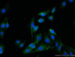 HOMER2 Antibody in Immunocytochemistry (ICC/IF)