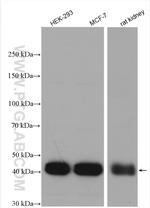 HOMER2 Antibody in Western Blot (WB)