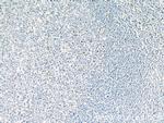 P2RX7 Antibody in Immunohistochemistry (Paraffin) (IHC (P))