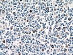 P2RX7 Antibody in Immunohistochemistry (Paraffin) (IHC (P))
