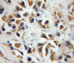 P2RX7 Antibody in Immunohistochemistry (Paraffin) (IHC (P))