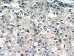 gamma catenin Antibody in Immunohistochemistry (Paraffin) (IHC (P))