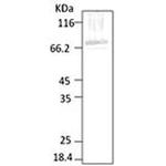 Hsp70 Antibody in Western Blot (WB)
