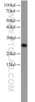 CBP/EIF4E Antibody in Western Blot (WB)