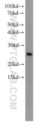 CBP/EIF4E Antibody in Western Blot (WB)