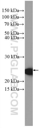 CBP/EIF4E Antibody in Western Blot (WB)