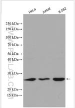 CBP/EIF4E Antibody in Western Blot (WB)