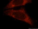 CBP/EIF4E Antibody in Immunocytochemistry (ICC/IF)