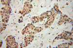 CBP/EIF4E Antibody in Immunohistochemistry (Paraffin) (IHC (P))