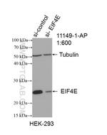 CBP/EIF4E Antibody in Western Blot (WB)