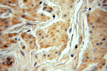 MYEOV Antibody in Immunohistochemistry (Paraffin) (IHC (P))