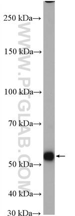 MYEOV Antibody in Western Blot (WB)
