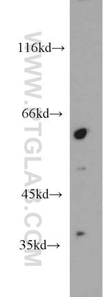 MYEOV Antibody in Western Blot (WB)