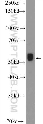 MYEOV Antibody in Western Blot (WB)