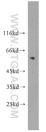 MYEOV Antibody in Western Blot (WB)