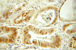 SMARCD2 Antibody in Immunohistochemistry (Paraffin) (IHC (P))