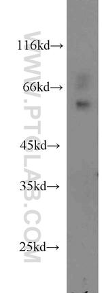SMARCD2 Antibody in Western Blot (WB)
