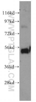 SMARCD2 Antibody in Western Blot (WB)