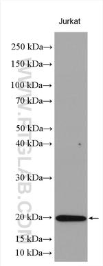 Stathmin 1 Antibody in Western Blot (WB)