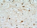 Stathmin 1 Antibody in Immunohistochemistry (Paraffin) (IHC (P))