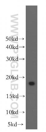 Stathmin 1 Antibody in Western Blot (WB)