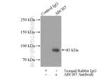 ABCB7 Antibody in Immunoprecipitation (IP)