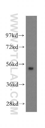 FBXO9 Antibody in Western Blot (WB)