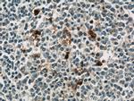EIF2S3 Antibody in Immunohistochemistry (Paraffin) (IHC (P))