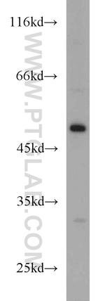 EIF2S3 Antibody in Western Blot (WB)