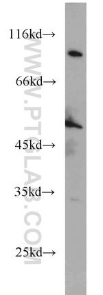 EIF2S3 Antibody in Western Blot (WB)
