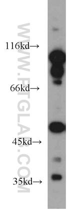 EIF2S3 Antibody in Western Blot (WB)