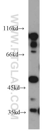 EIF2S3 Antibody in Western Blot (WB)