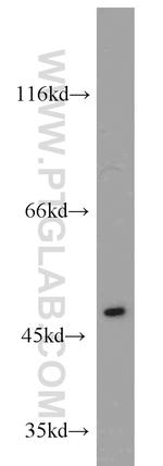 EIF2S3 Antibody in Western Blot (WB)
