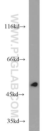 EIF2S3 Antibody in Western Blot (WB)