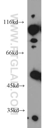 EIF2S3 Antibody in Western Blot (WB)