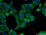 EIF2S3 Antibody in Immunocytochemistry (ICC/IF)