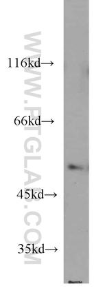 EIF2S3 Antibody in Western Blot (WB)