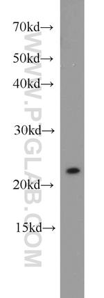 RGS10 Antibody in Western Blot (WB)